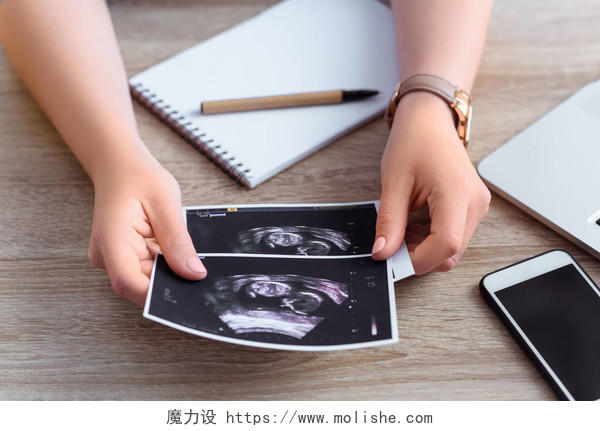 女性拿着的胎儿超声扫描照片